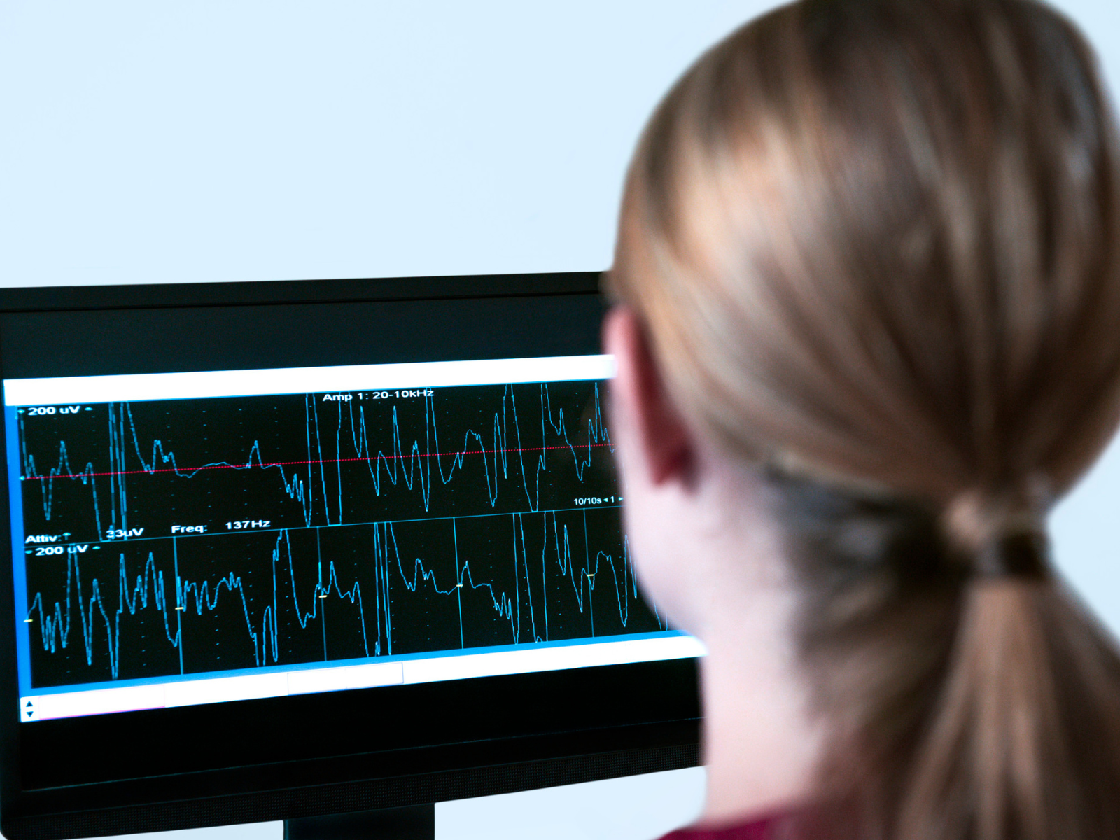 Tvoya opora (Your Support) announces a tender for the purchase of an electromyoneurograph.