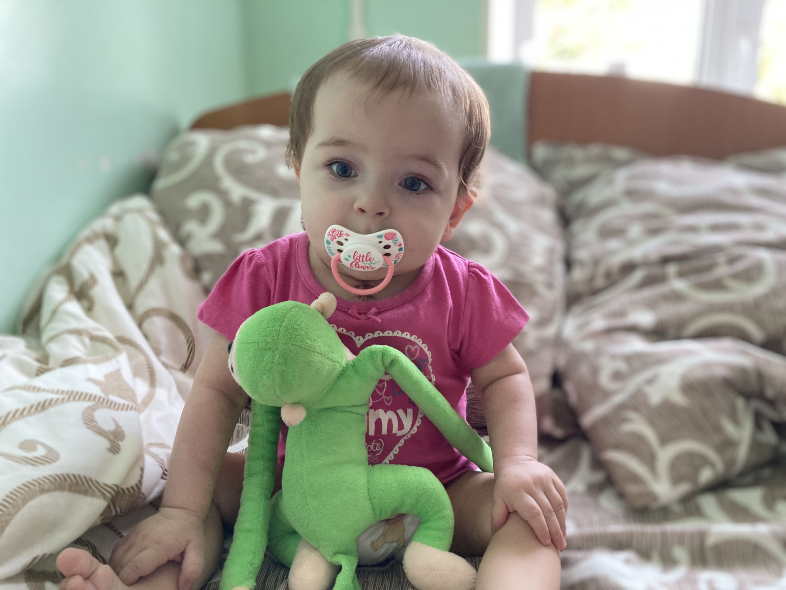 Switched vessels in Amelia's heart.